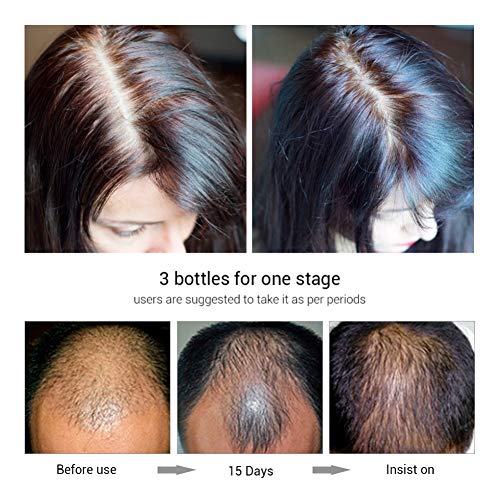 Onewell 20 ml Saç Büyüme Serumu, Vahşi Büyüme Saç Spreyi, Erkekler ve Kadınlar için Saç Çıkma, Saç ve Saç Derisi Tedavisi