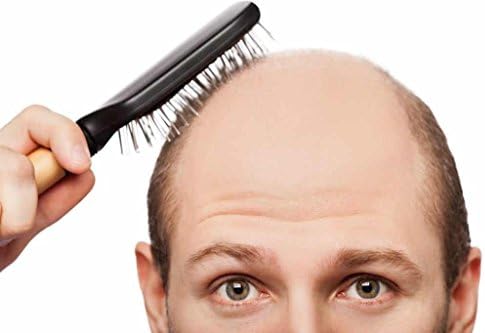 Saç Dökülmesi Takviyeleri Vitaminler-DHT Engelleyici Saç Formülü-Erkekler ve Kadınlar için-Saw Palmetto Özü - 2 Şişe 120 Kaplı